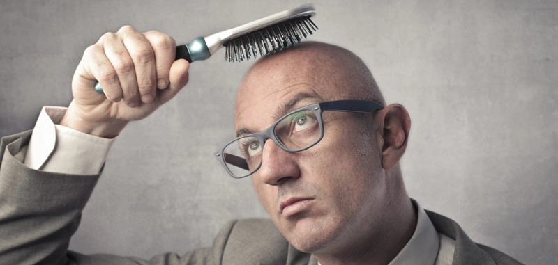 Men's hair loss treatments and solutions